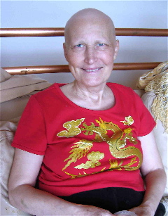 Joyce bald smile